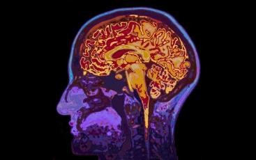 Effects of addiction results in poisoning the brain